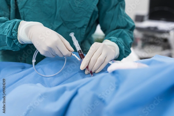 Fototapeta insert guide wire