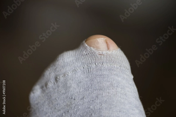 Fototapeta Big Toe coming through hole in torn sock