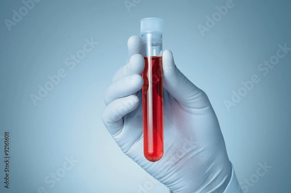 Obraz Ręka z próbką krwi