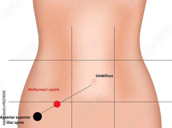 Fototapeta Punkt McBurneya