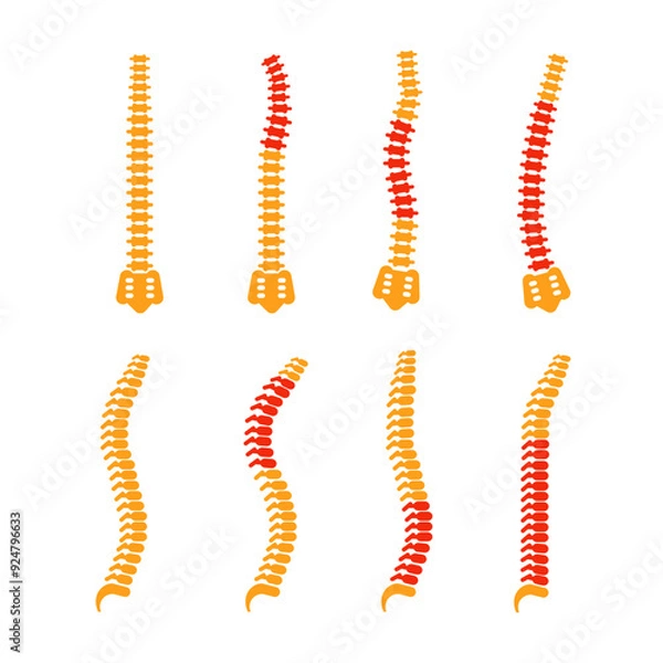 Fototapeta Comparing different human spine shapes with correct and incorrect posture, highlighting back pain areas