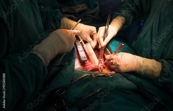 Fototapeta open heart surgery team
