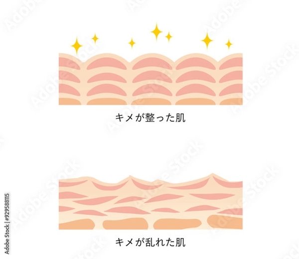 Obraz 図版_肌図版_001_整った肌と乱れた肌