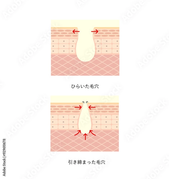 Obraz 図版_肌図版_004_毛穴のひらきと引き締め