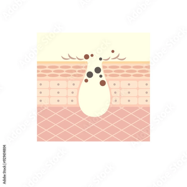 Obraz 図版_肌図版_005_毛穴と角質の汚れ