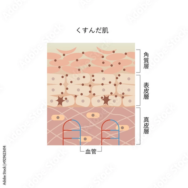 Obraz 図版_肌図版_007_くすんだ肌