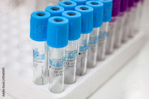 Fototapeta test tubes for testing