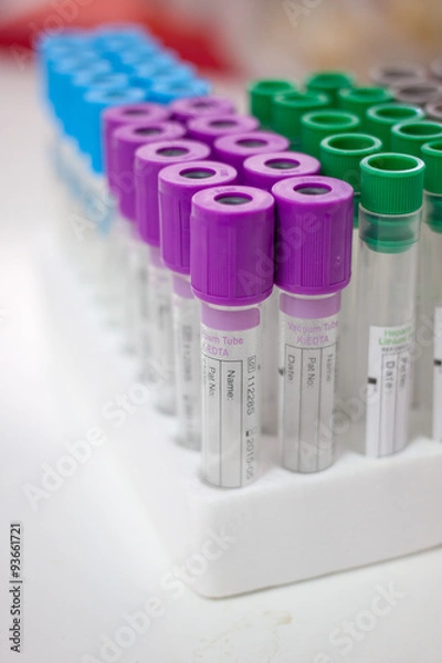 Fototapeta test tubes for testing