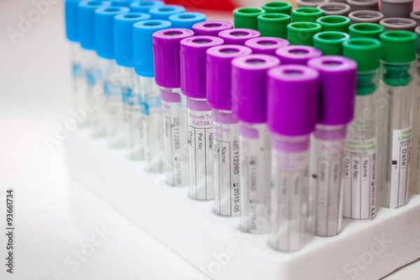 Fototapeta test tubes for testing