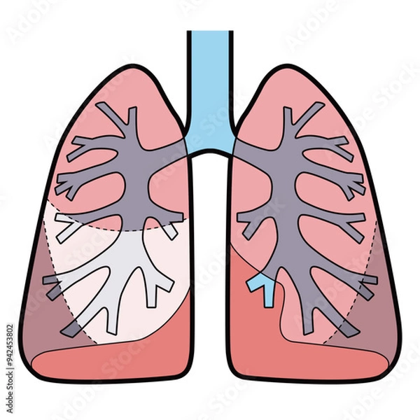 Fototapeta 肺　図解