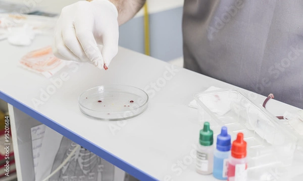 Fototapeta hands of the doctor doing the analysis and a blood sample at a table with gloves