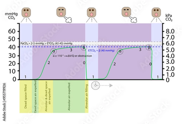 Obraz Capnography Waveform Detailed Infographic