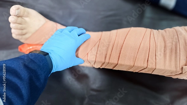 Fototapeta splinting a leg bitten by a snake