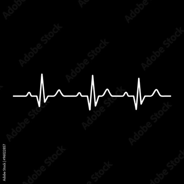 Obraz Vector Illustration heart rhythm ekg .
