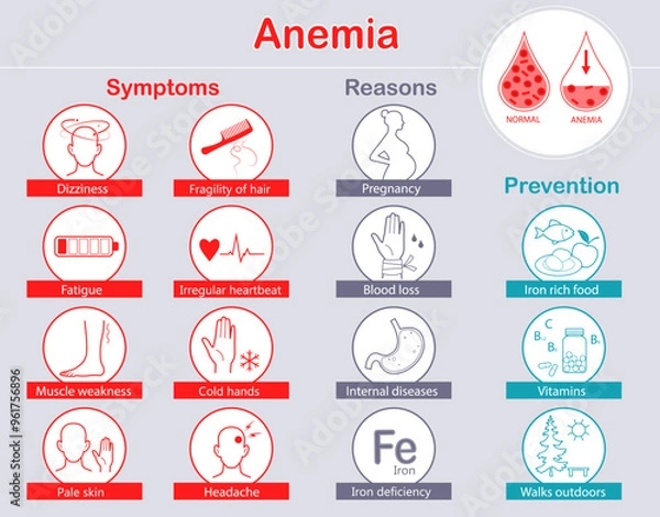 Obraz Infographic of anemia symptoms, reasons and prevention. Medical info poster. Set of Icons. Flat vector illustration