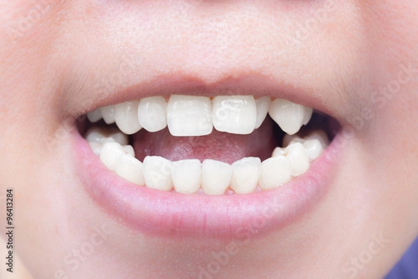 Fototapeta The teeth.