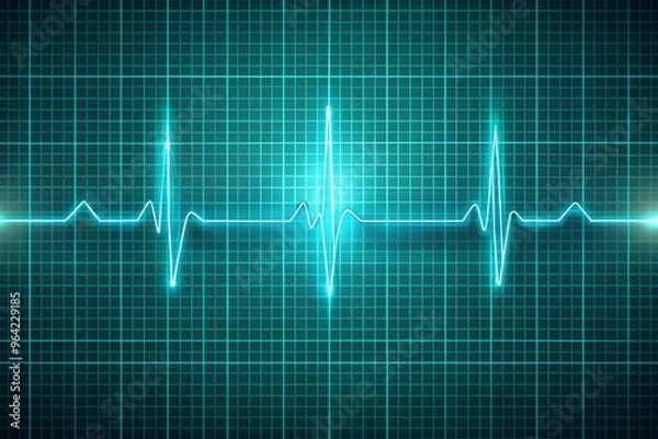 Obraz High-quality digital art of an electrocardiogram strip displaying right axis deviation with precise and vivid amplitude and interval measurements on a subtle grid background