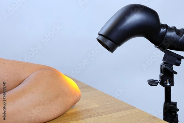 Fototapeta Therapeutic lamp for light rehabilitation, improving the condition of inflamed joints and more.