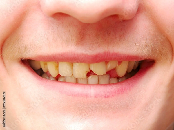 Fototapeta dream of dentist