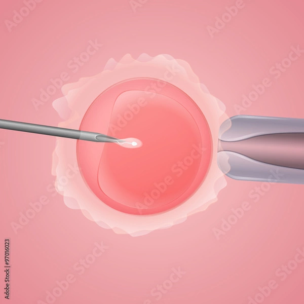 Obraz in vitro fertilization