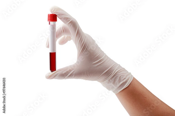 Obraz Hand holding test tube with blood plasma ready for testing isola