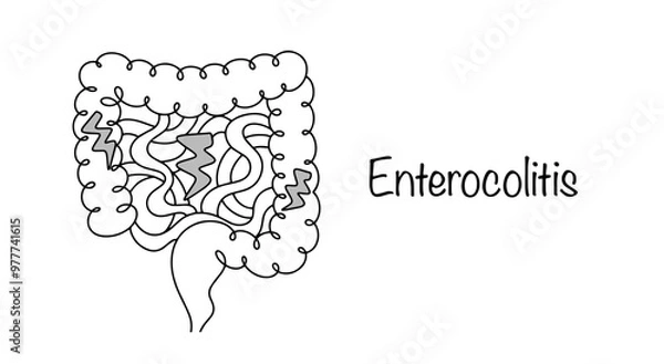 Fototapeta Enterocolitis