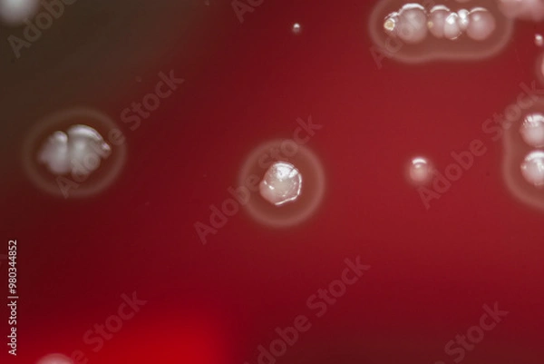 Obraz Bacterial colonies growing on agar plate.