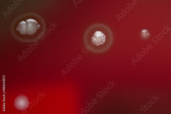 Obraz Bacterial colonies growing on agar plate.