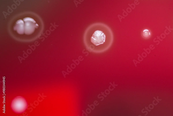Obraz Bacterial colonies growing on agar plate.