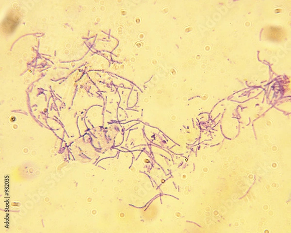 Fototapeta mikroskop wąglika Bacillus anthracis