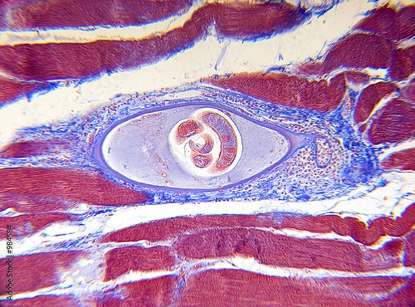 Fototapeta microscope-trichinella spiralis