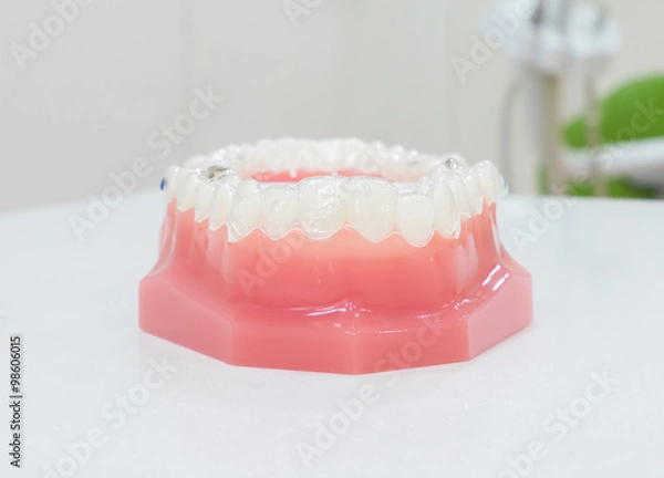 Fototapeta denture
