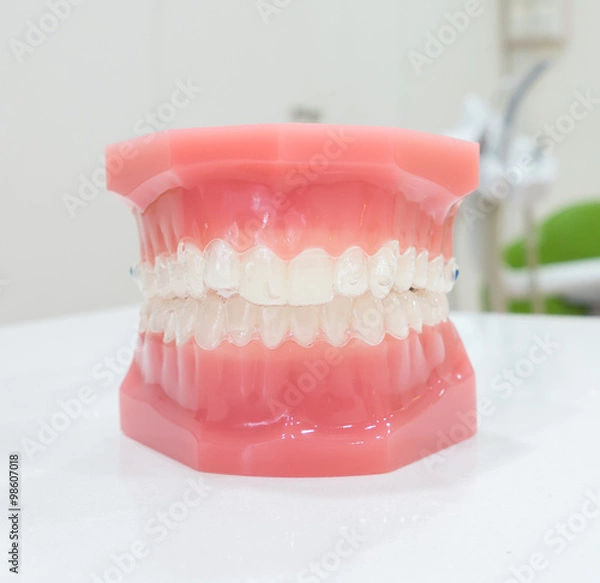 Fototapeta denture
