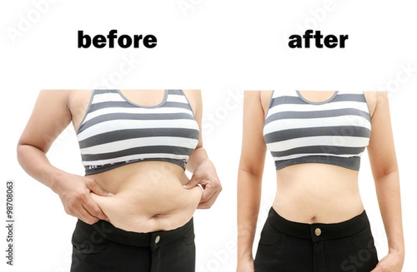 Obraz  after a diet