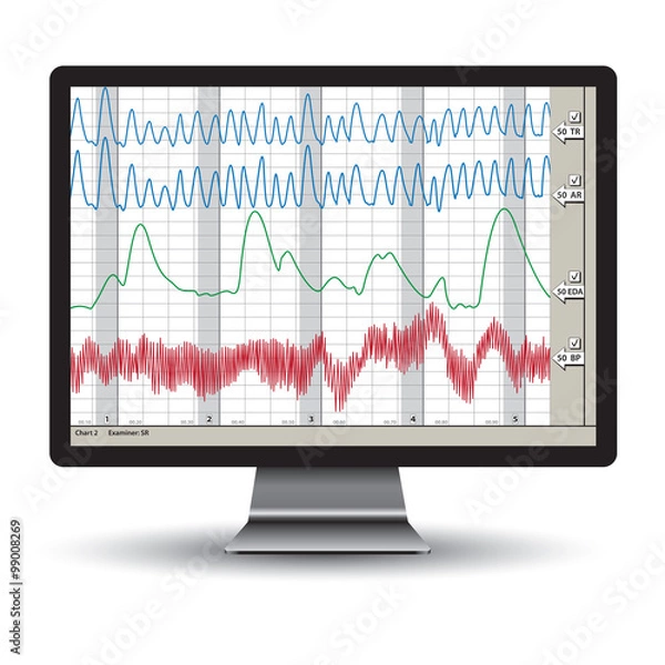 Obraz Polygraph test