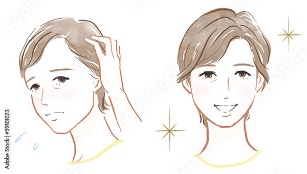 Obraz 薄毛の悩み、ウィッグのイメージ