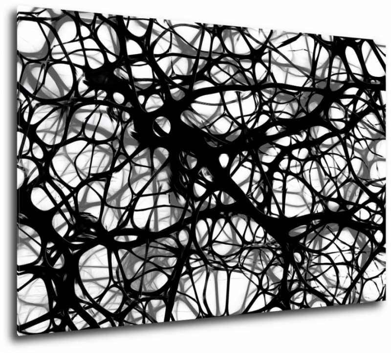 Obraz na plátne Neuróny